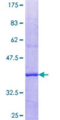 SDS-PAGE Recombinant Human PLA2G6 GST (N-Term) Protein