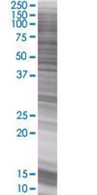 PLA2G10 transfected lysate.