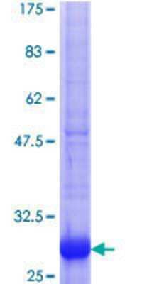 SDS-Page: Recombinant Human Annexin A9 Protein [H00008416-Q01] - 12.5% SDS-PAGE Stained with Coomassie Blue.