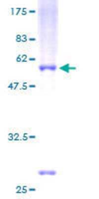 12.5% SDS-PAGE Stained with Coomassie Blue.