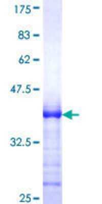 12.5% SDS-PAGE Stained with Coomassie Blue.