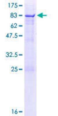 SDS-PAGE Recombinant Human SDPR GST (N-Term) Protein