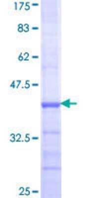 SDS-Page: Recombinant Human GNPAT Protein [H00008443-Q01] - 12.5% SDS-PAGE Stained with Coomassie Blue.