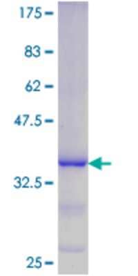 Recombinant Human DUSP11 Protein [H00008446-Q01] - 12.5% SDS-PAGE Stained with Coomassie Blue.