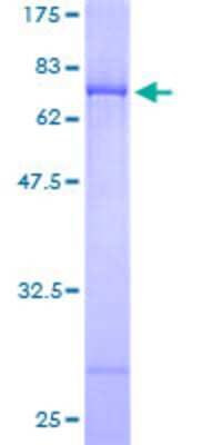 12.5% SDS-PAGE Stained with Coomassie Blue.