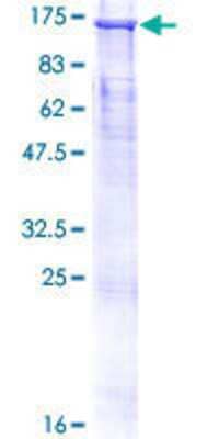 12.5% SDS-PAGE Stained with Coomassie Blue.