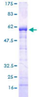 SDS-Page: Recombinant Human SPT3 Protein [H00008464-P01] - 12.5% SDS-PAGE Stained with Coomassie Blue.