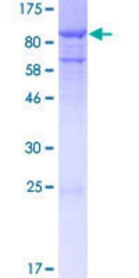 12.5% SDS-PAGE Stained with Coomassie Blue.