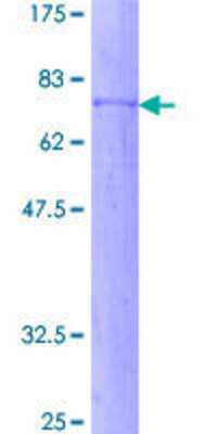 12.5% SDS-PAGE Stained with Coomassie Blue.