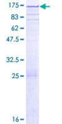 12.5% SDS-PAGE Stained with Coomassie Blue.