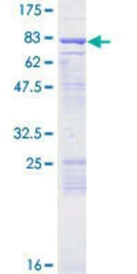 SDS-Page: Recombinant Human ENC1 Protein [H00008507-P01] - 12.5% SDS-PAGE Stained with Coomassie Blue.