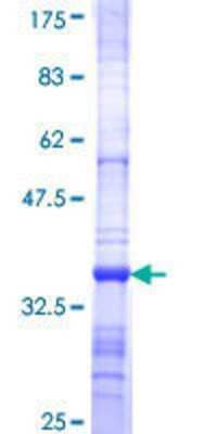 12.5% SDS-PAGE Stained with Coomassie Blue.