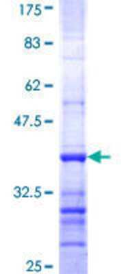 SDS-Page: Recombinant Human Gastric Lipase Protein [H00008513-Q01] - 12.5% SDS-PAGE Stained with Coomassie Blue.