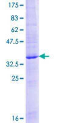 12.5% SDS-PAGE Stained with Coomassie Blue.