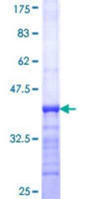 SDS-Page: Recombinant Human DGK-epsilon Protein [H00008526-Q01] - 12.5% SDS-PAGE Stained with Coomassie Blue.