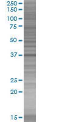 CBX4 transfected lysate.