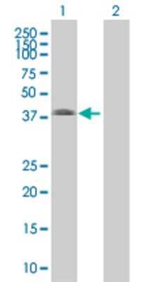 Lane 1: CBX4 transfected lysate (32 KDa) Lane 2: Non-transfected lysate.