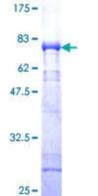 Other Recombinant Human CaM Kinase I GST (N-Term) Protein