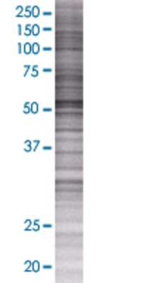 CDC14B transfected lysate.