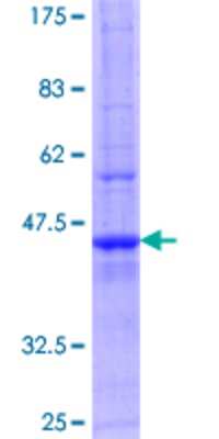 12.5% SDS-PAGE Stained with Coomassie Blue.
