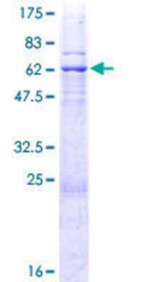 12.5% SDS-PAGE Stained with Coomassie Blue.