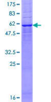 Recombinant Human DEGS1 Protein [H00008560-P01] - 12.5% SDS-PAGE Stained with Coomassie Blue.