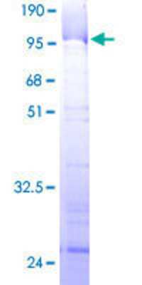 12.5% SDS-PAGE Stained with Coomassie Blue.