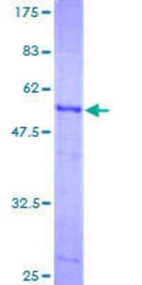 12.5% SDS-PAGE Stained with Coomassie Blue.