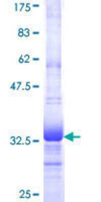 12.5% SDS-PAGE Stained with Coomassie Blue.