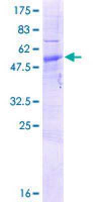 12.5% SDS-PAGE Stained with Coomassie Blue.