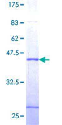 12.5% SDS-PAGE Stained with Coomassie Blue.