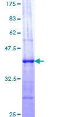 12.5% SDS-PAGE Stained with Coomassie Blue.