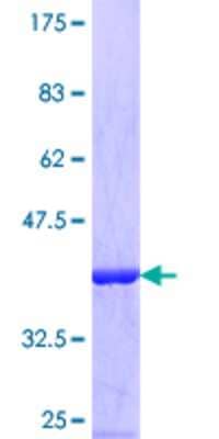 SDS-Page: Recombinant Human EIF3G Protein [H00008666-Q01] - 12.5% SDS-PAGE Stained with Coomassie Blue.