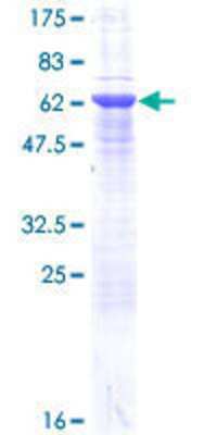 12.5% SDS-PAGE Stained with Coomassie Blue.