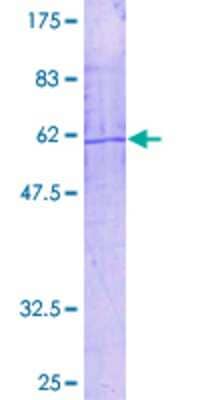 12.5% SDS-PAGE Stained with Coomassie Blue.