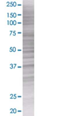 PLA2G4B transfected lysate.