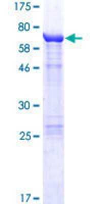 12.5% SDS-PAGE Stained with Coomassie Blue.