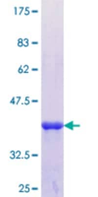 12.5% SDS-PAGE Stained with Coomassie Blue.