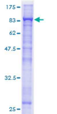 12.5% SDS-PAGE Stained with Coomassie Blue.