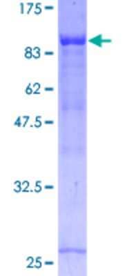 12.5% SDS-PAGE Stained with Coomassie Blue.