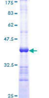 Recombinant Human TRADD Protein [H00008717-Q01] - 12.5% SDS-PAGE Stained with Coomassie Blue.