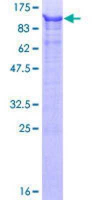 Other Recombinant Human URI GST (N-Term) Protein