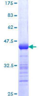 12.5% SDS-PAGE Stained with Coomassie Blue.