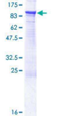 Other Recombinant Human CTNNAL1 GST (N-Term) Protein