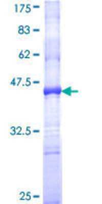 12.5% SDS-PAGE Stained with Coomassie Blue.