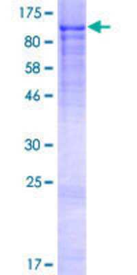 Other Recombinant Human ADAM7 GST (N-Term) Protein