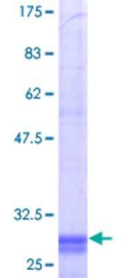 12.5% SDS-PAGE Stained with Coomassie Blue.