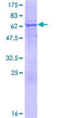 12.5% SDS-PAGE Stained with Coomassie Blue.