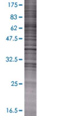 MTMR1 transfected lysate.