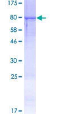 12.5% SDS-PAGE Stained with Coomassie Blue.